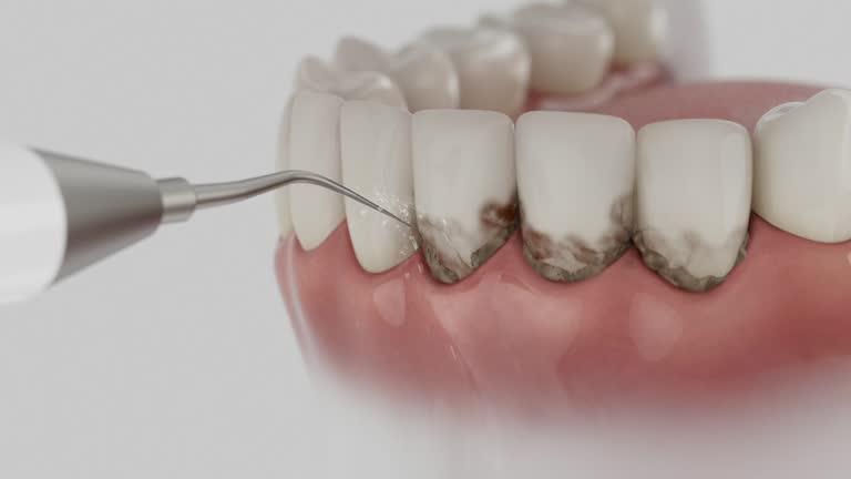 Reliable Dental contractor in Lemon Hill, CA by Dentist Open Now